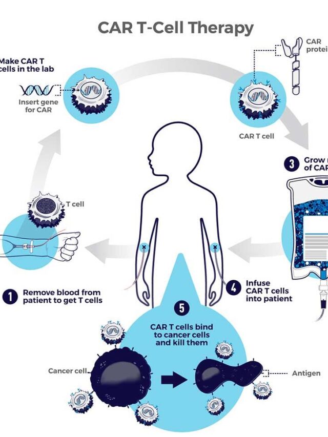 CAR-T-Cell-therapy-article